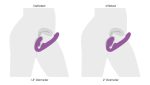 10x Ergo- Fit G-Pulse Inflatable and Vibrating Strapless Strap- on - Purple - Image 9
